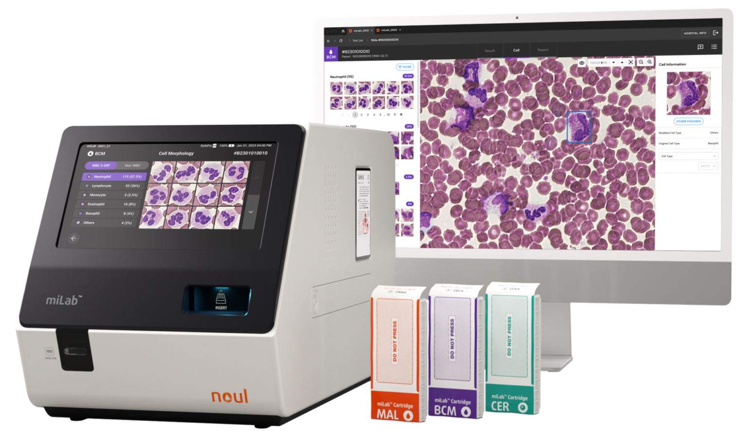 NOUL Blog | CBC Test Normal Ranges: 5 WBC Types and Key Blood Cell Counts