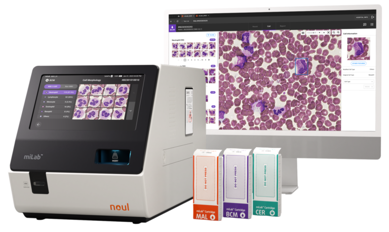 NOUL Blog | CBC Test Normal Ranges: 5 WBC Types and Key Blood Cell Counts