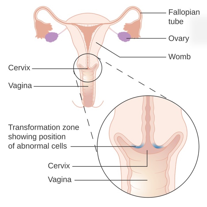 Female reproductive system, Squamocolumnar junction, Cervical transformational zone, Cervix, Health screening test