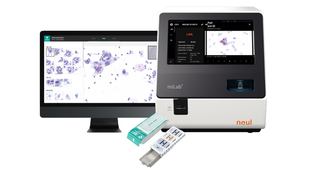 LSIL, HSIL, NILM, ASC-H, Squamous Cell Carcinoma, Atypical Squamous Cells with Unparalleled precision