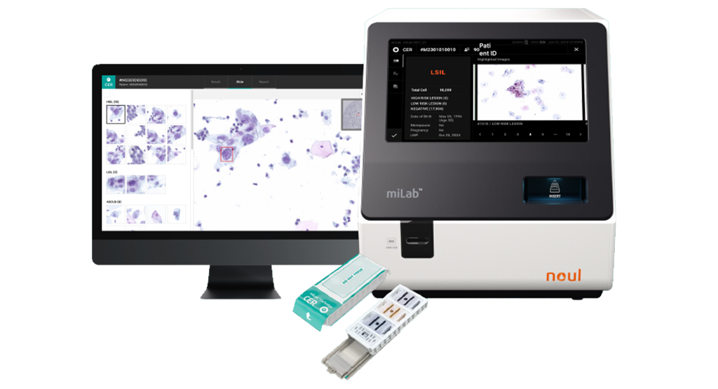 Female reproductive system, Squamocolumnar junction, Cervical transformational zone, Cervix, Health screening test