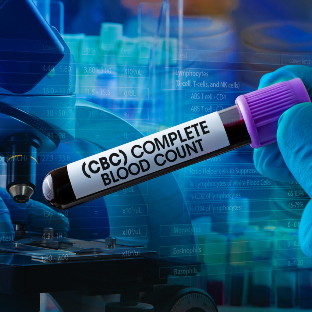 CBC test normal ranges, WBC normal range, Normal absolute Neutrophil count, Eosinophils normal range, Monocytes normal range