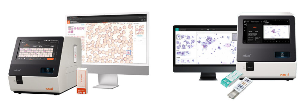 UNITAID, Precancerous lesion, Cervical intraepithelial neoplasia, Cytology