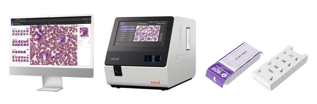 nRBC blood test, nucleated red cells, absolute nRBC, nucleated blood cells normal range