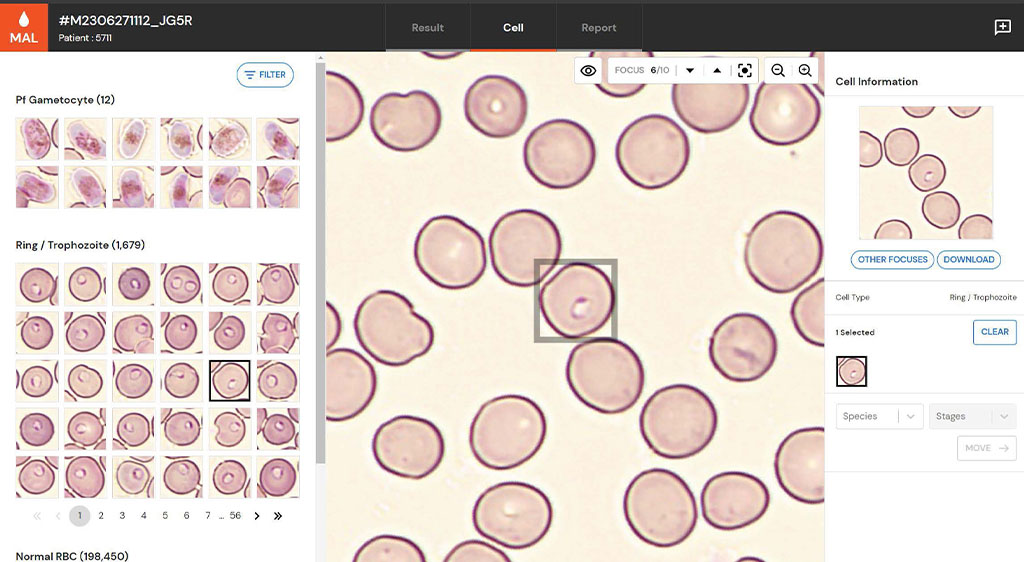 Malaria detection, Malaria prevention, Protein-protein interaction, Antimalarial drugs, Non-endemic