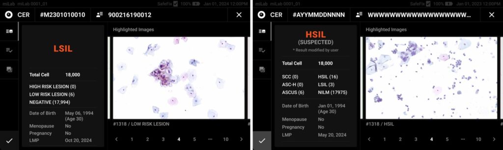 LSIL, HSIL, NILM, ASC-H, Squamous Cell Carcinoma, Atypical Squamous Cells with Unparalleled precision