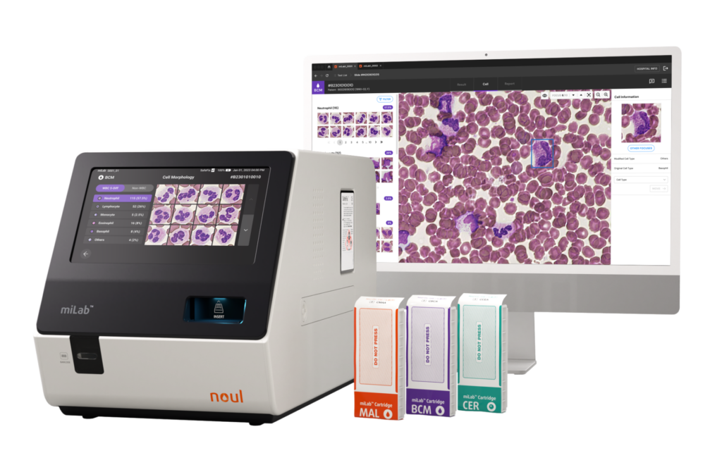 nRBC blood test, nucleated red cells, absolute nRBC, nucleated blood cells normal range