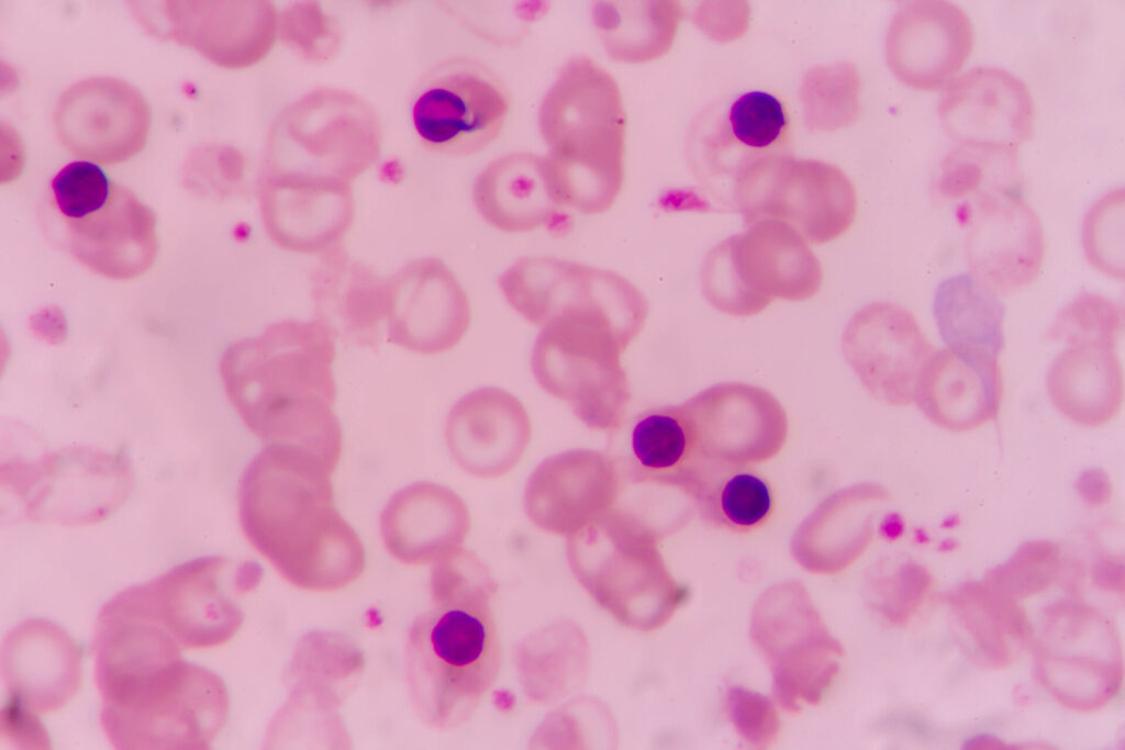 nRBC blood test, nucleated red cells, absolute nRBC, nucleated blood cells normal range