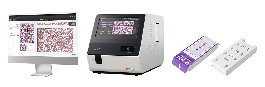 nRBC blood test, nucleated red cells, absolute nRBC, nucleated blood cells normal range