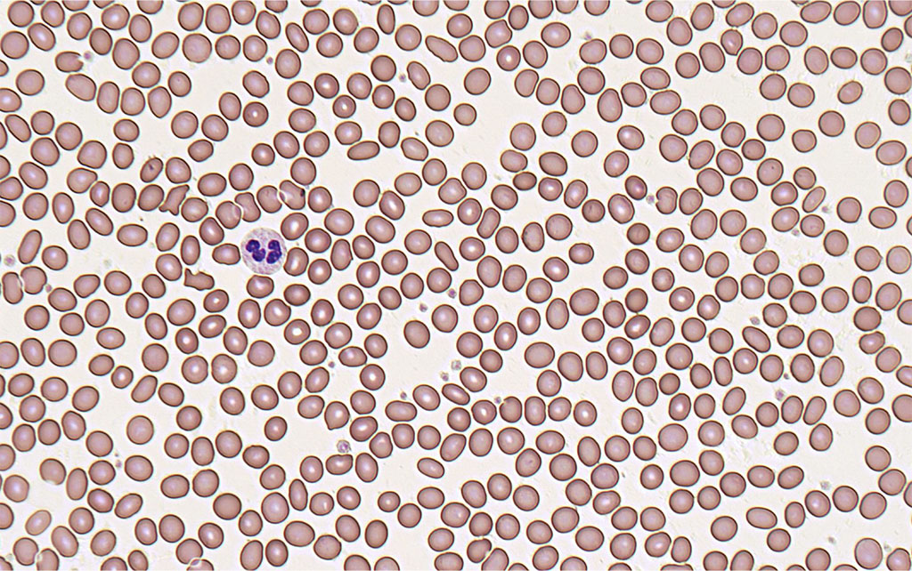 nRBC blood test, nucleated red cells, absolute nRBC, nucleated blood cells normal range