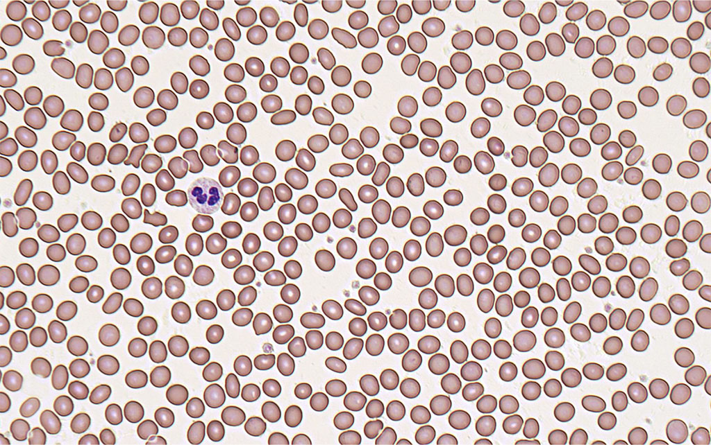 NOUL Blog NRBC Blood Test Why Accurate Detection Is Critical And How 