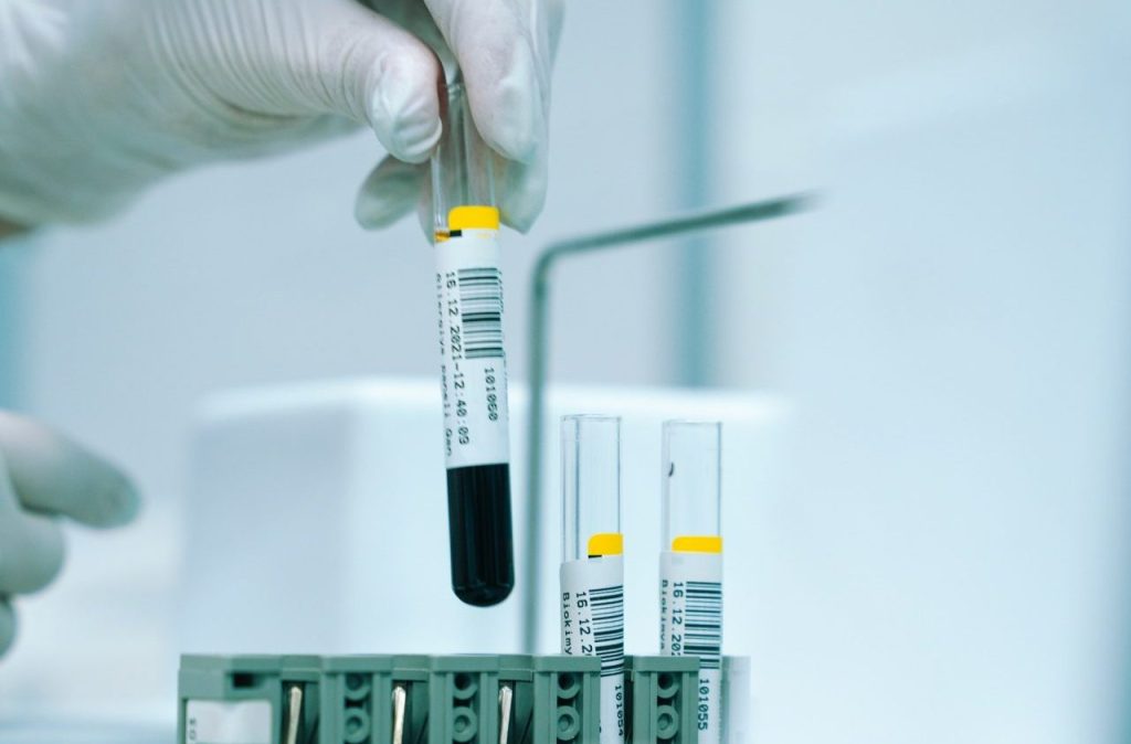 malaria test, blood donation testing, blood donation requirements, donor blood processing