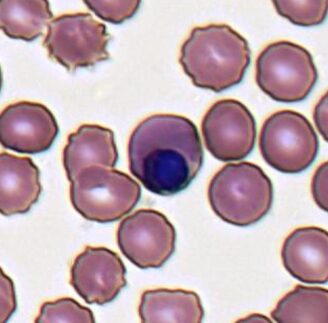 nRBC blood test, nucleated red cells, absolute nRBC, nucleated blood cells normal range