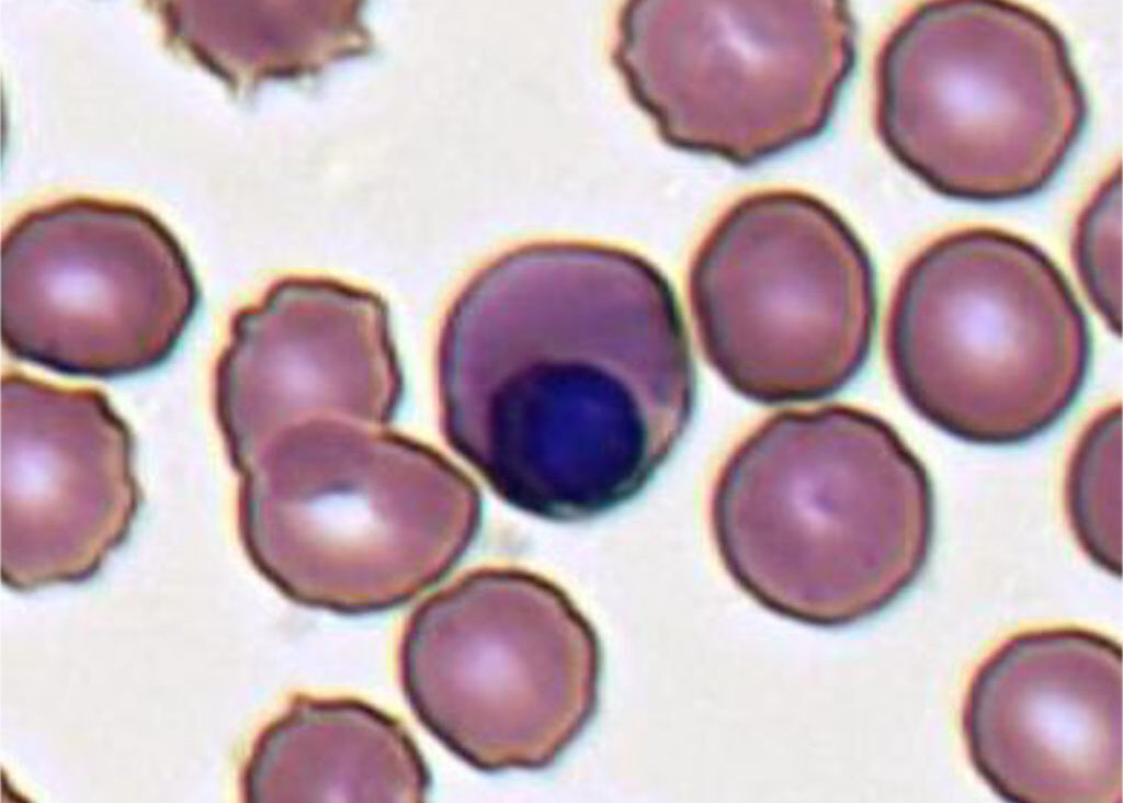 nRBC blood test, nucleated red cells, absolute nRBC, nucleated blood cells normal range