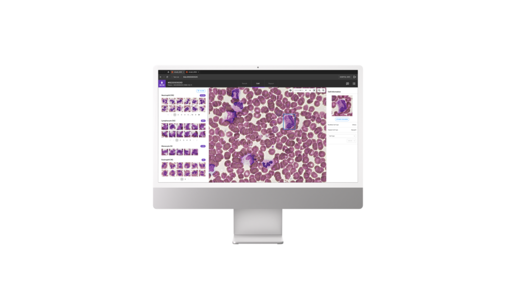 nRBC blood test, nucleated red cells, absolute nRBC, nucleated blood cells normal range