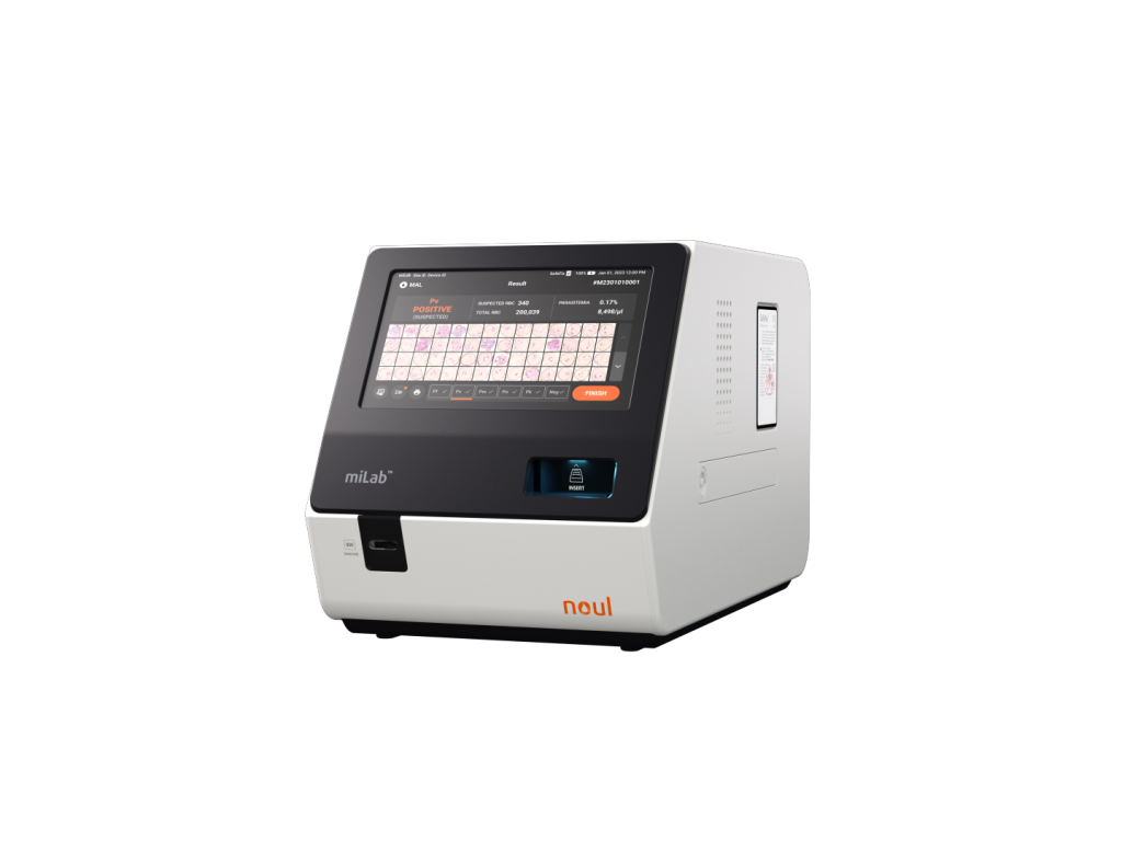 AI malaria diagnostic, AI diagnostic, malaria diagnostic, POC malaria diagnostic, malaria diagnosis platform, malaria analysis, malaria
