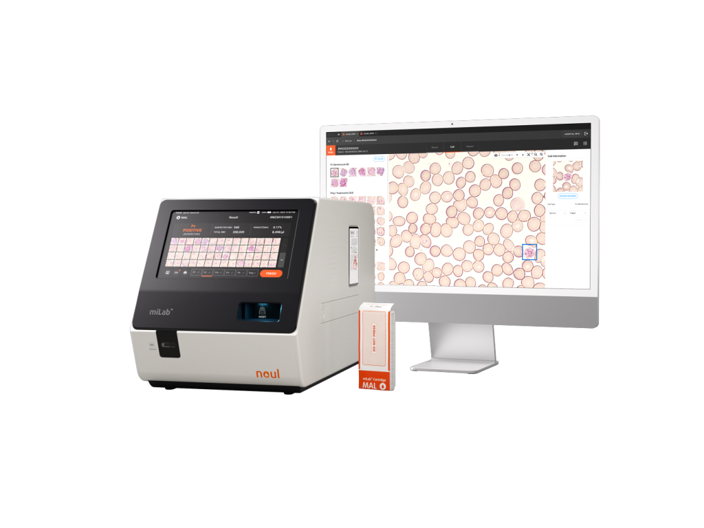 miLab, malaria diagnostic, diagnosis, malaria diagnostic, malaria diagnosis platform, malaria diagnosis, ai diagnostic