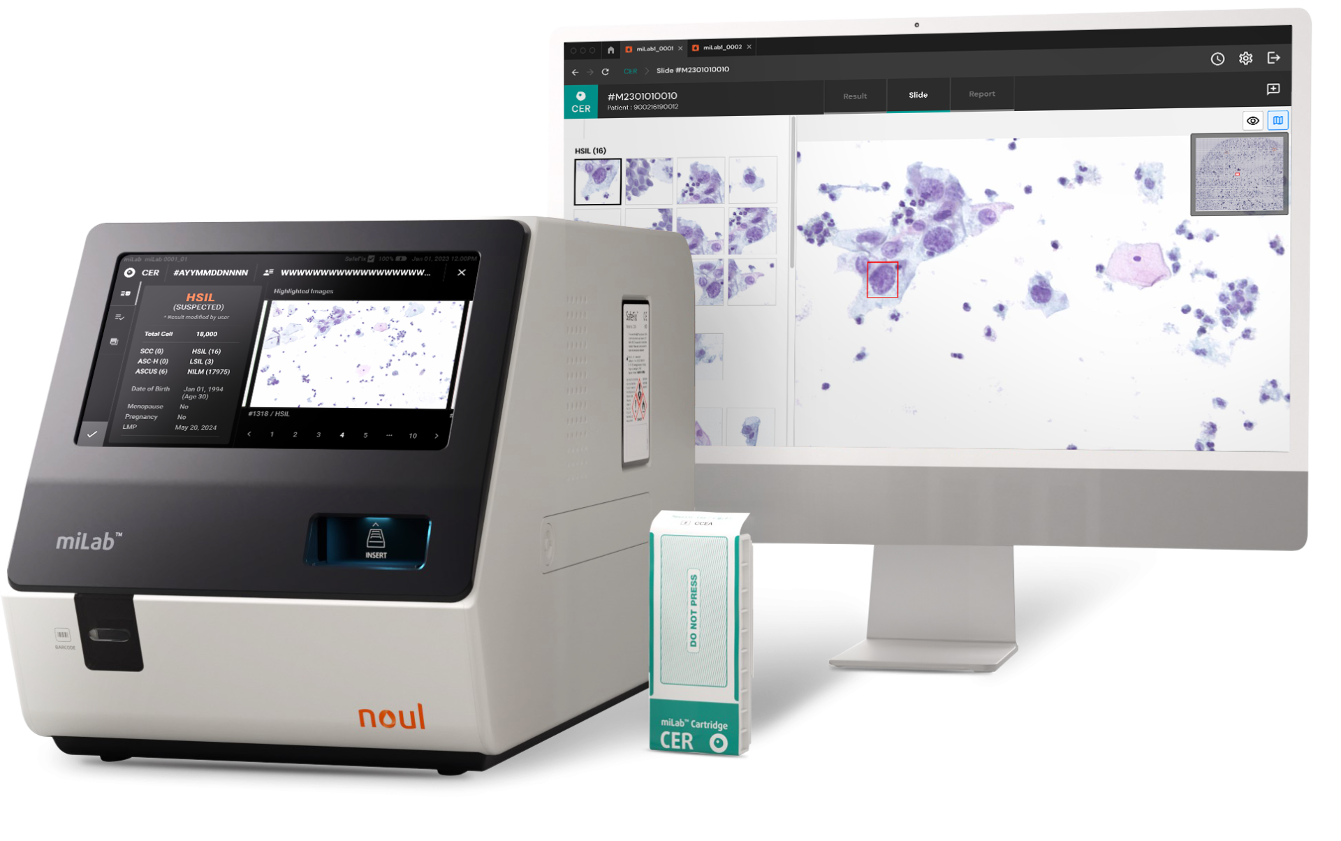 cervical cell, cervical cancer, cervical cell screening, cervical cancer diagnostic, cervical cell analysis