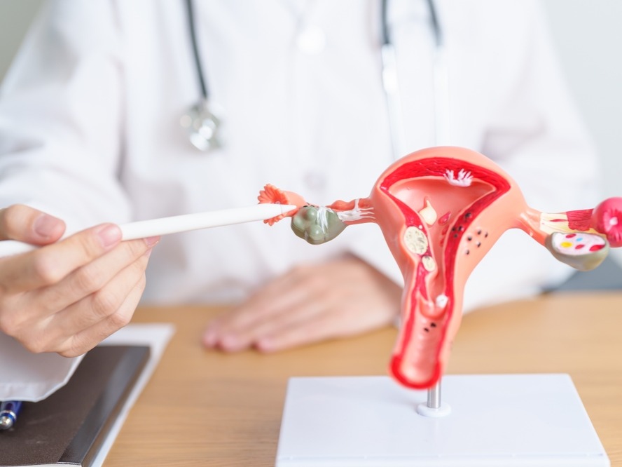 cervical cancer, global health concern, cevical, cervical cell, women cancer