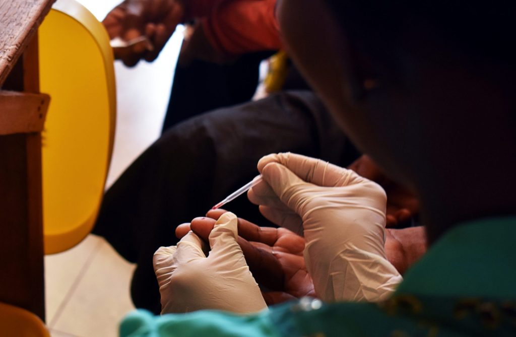 malaria, malaria diagnostic, malaria diagnosis, diagnostic