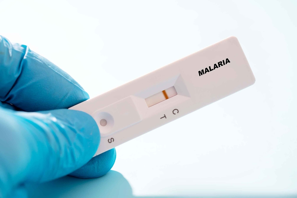 malaria, malaria RDT, malaria diagnostic, malaria diagnosis, RDT