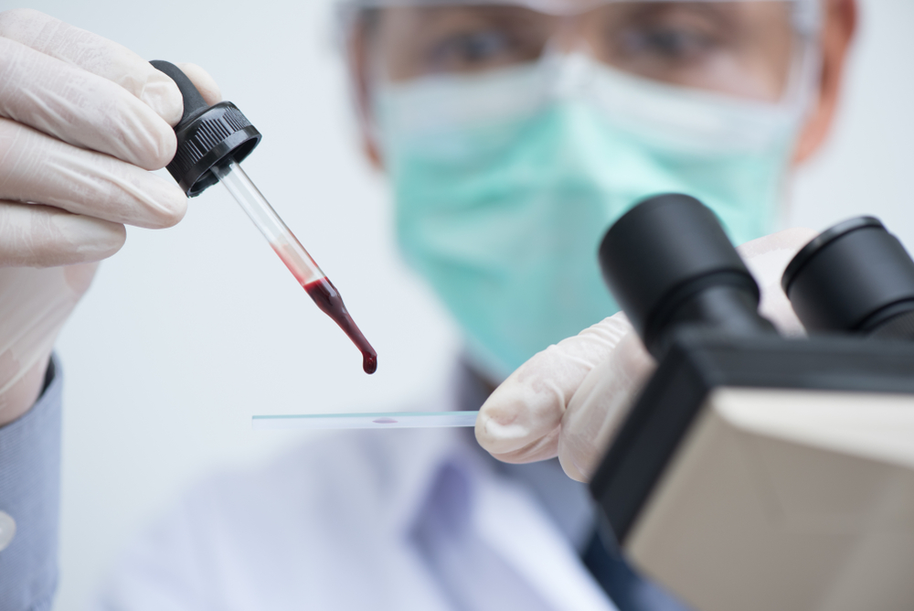 malaria, malaria diagnosis, malaria diagnostic, AI diagnostic