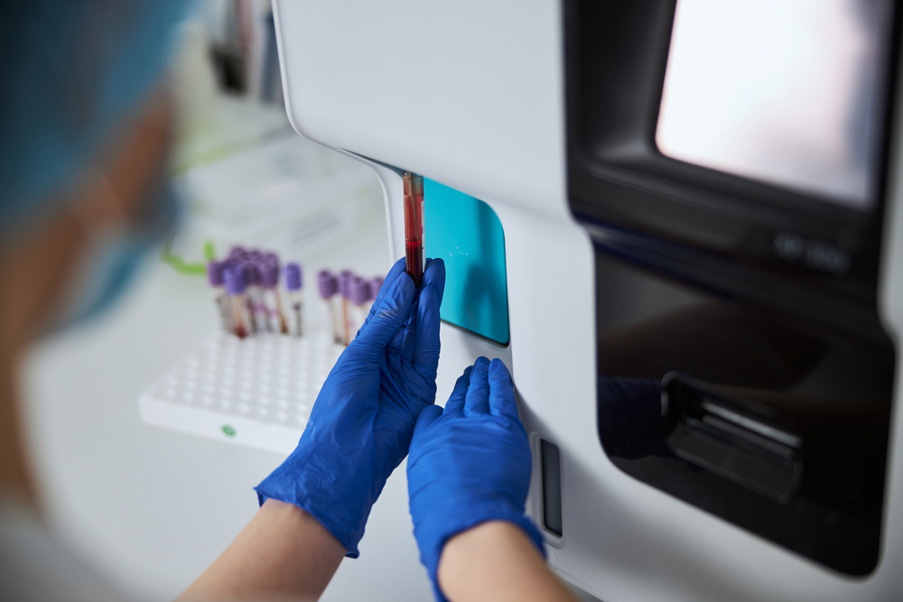 CBC, Blood morphology, Blood test, POC diagnostic, AI diagnostic