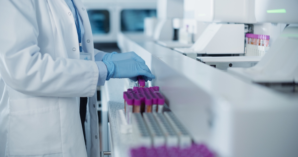 CBC, Blood morphology, Blood test, POC diagnostic, AI diagnostic