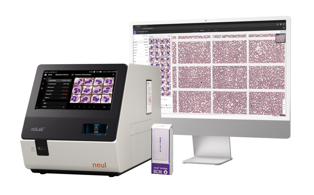 point-of-care, hematology, AI, CBC, diagnostics