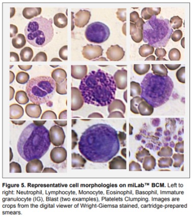point-of-care, hematology, AI, CBC, diagnostics